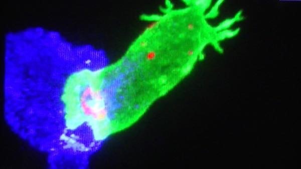 超高性能顕微鏡がとらえた免疫細胞ががん細胞を殺す瞬間
