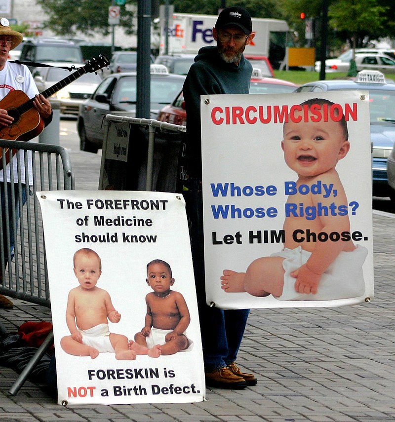 乳児への割礼の反対運動（アメリカ合衆国）